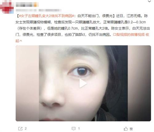 女子左眼瞳孔變大2倍找不到病因：日間光照引發(fā)畏光癥狀