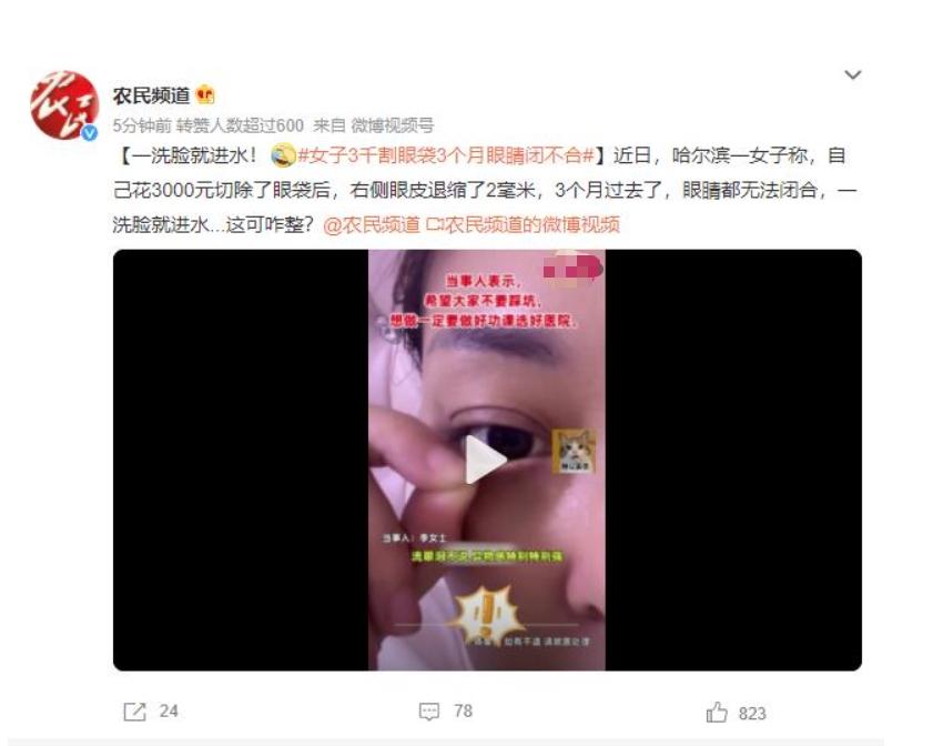 眼袋手術(shù)后3個月眼睛閉不合，女子苦惱洗臉進水該如何解決？