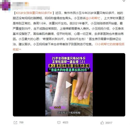 焦作25歲女孩體重只有60多斤，求助中醫(yī)辨證論治